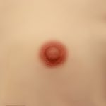 2 cm