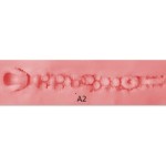 Anal 2
