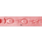 Vaginal 2