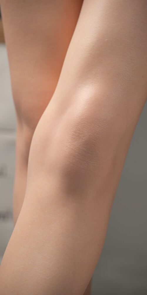 Somi - Imagen 14